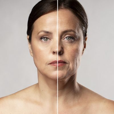 before-after-portrait-sdbeautylondon